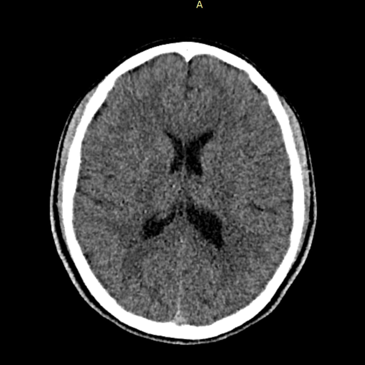 David Tafur Muñoz-1874