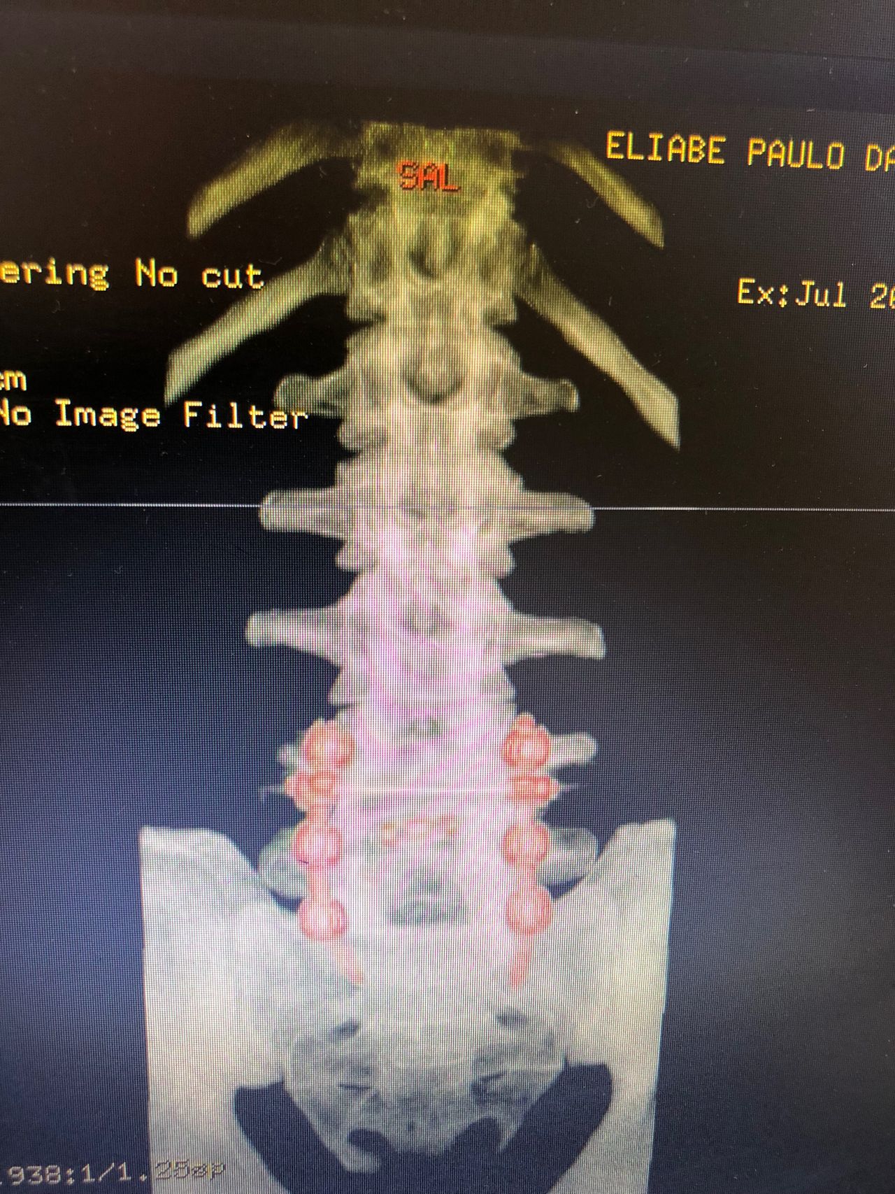 José Lopes Sousa Filho-21