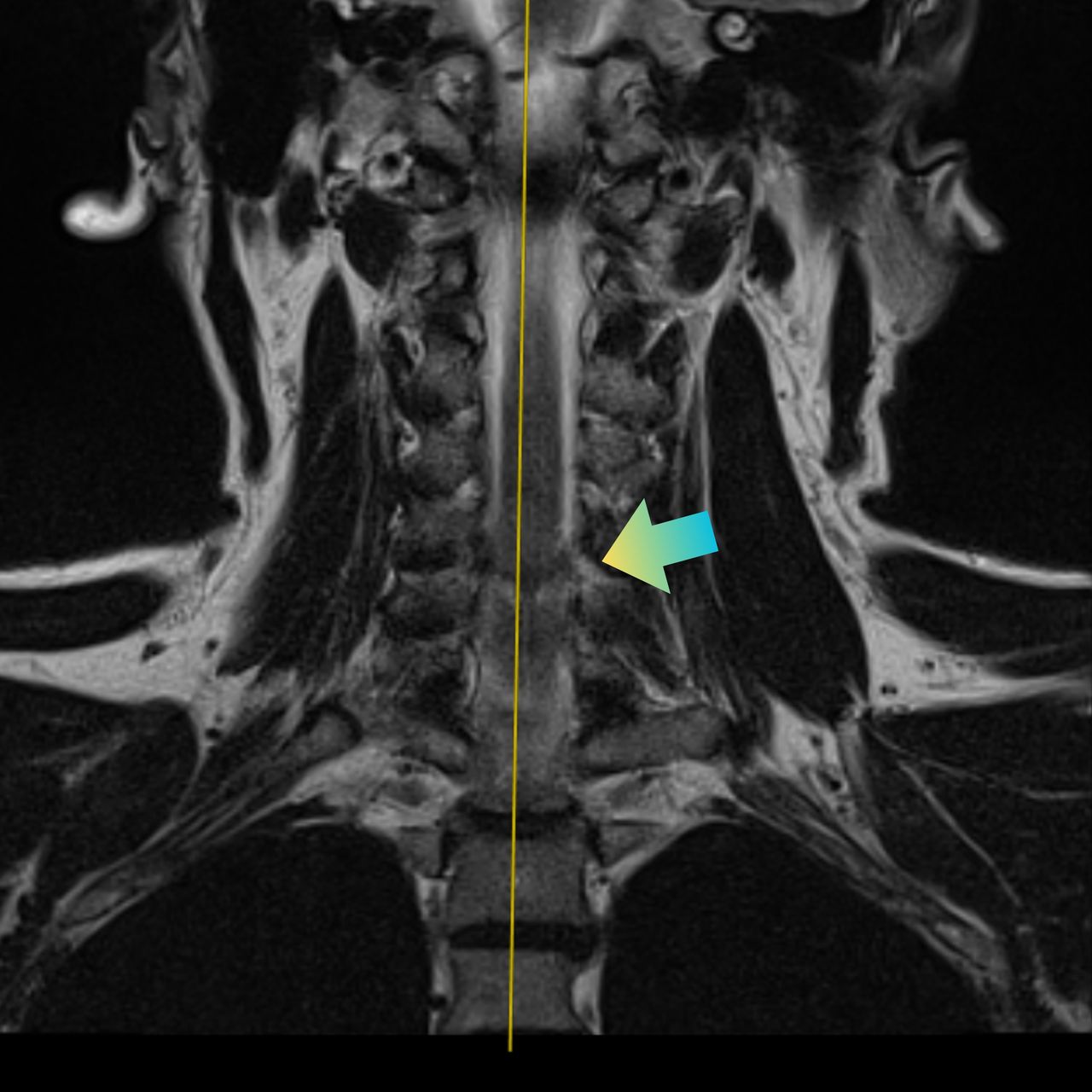 David Tafur Muñoz-2431