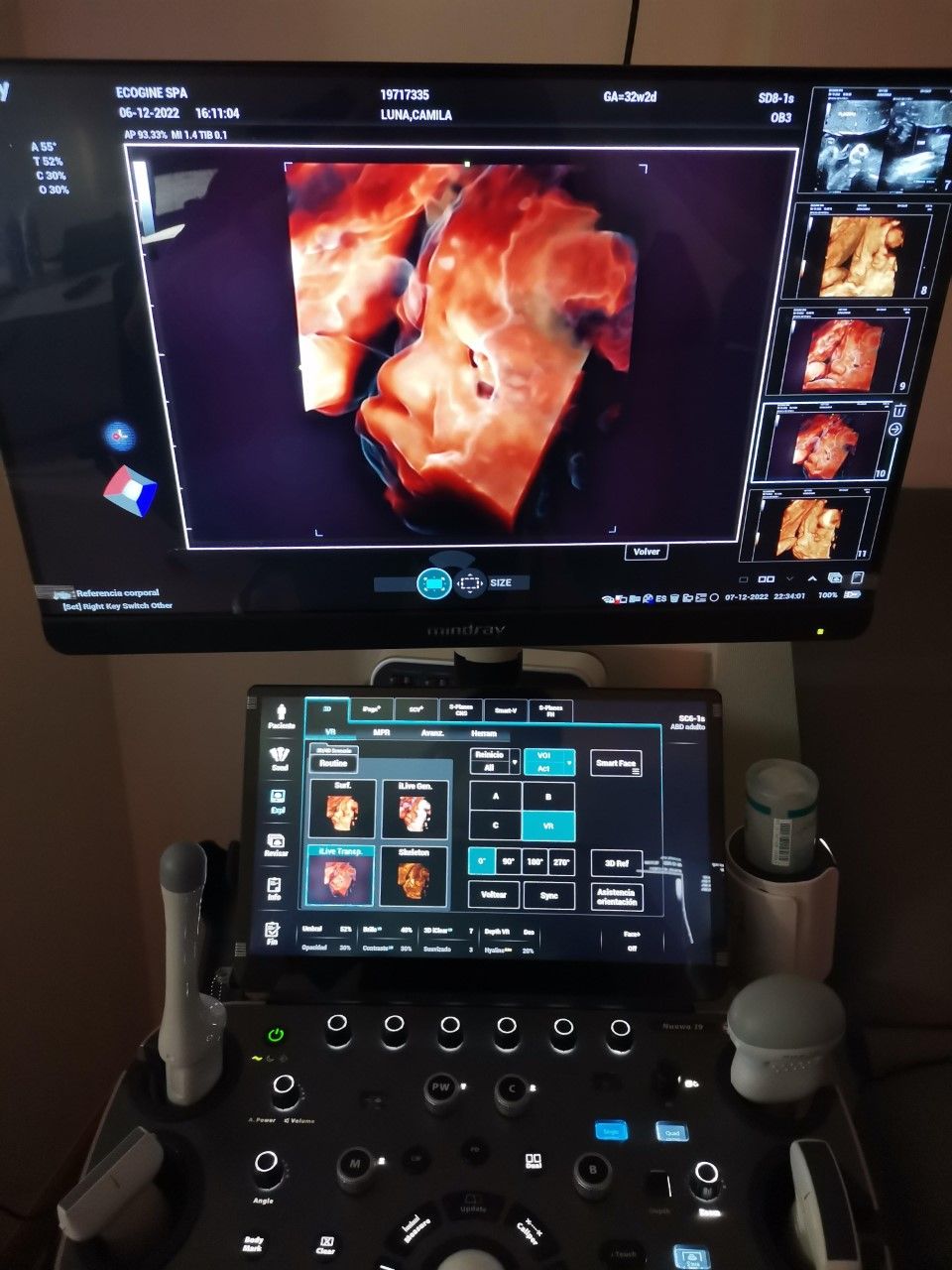 Marcelo Fierro Jarrin-10