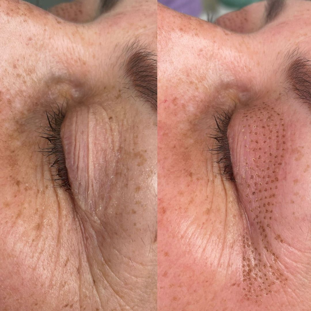 Scarlett Bartsch Ferrada-29