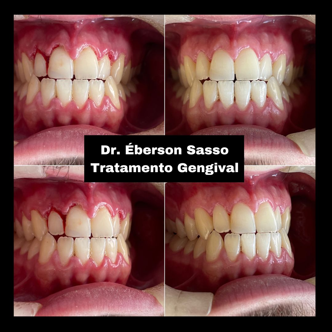 Éberson Luis Marques Sasso-6