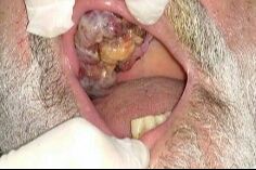 Alexandre Giannini-11