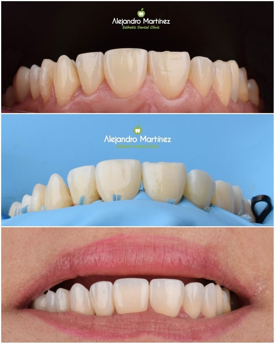 Alejandro Martinez-17