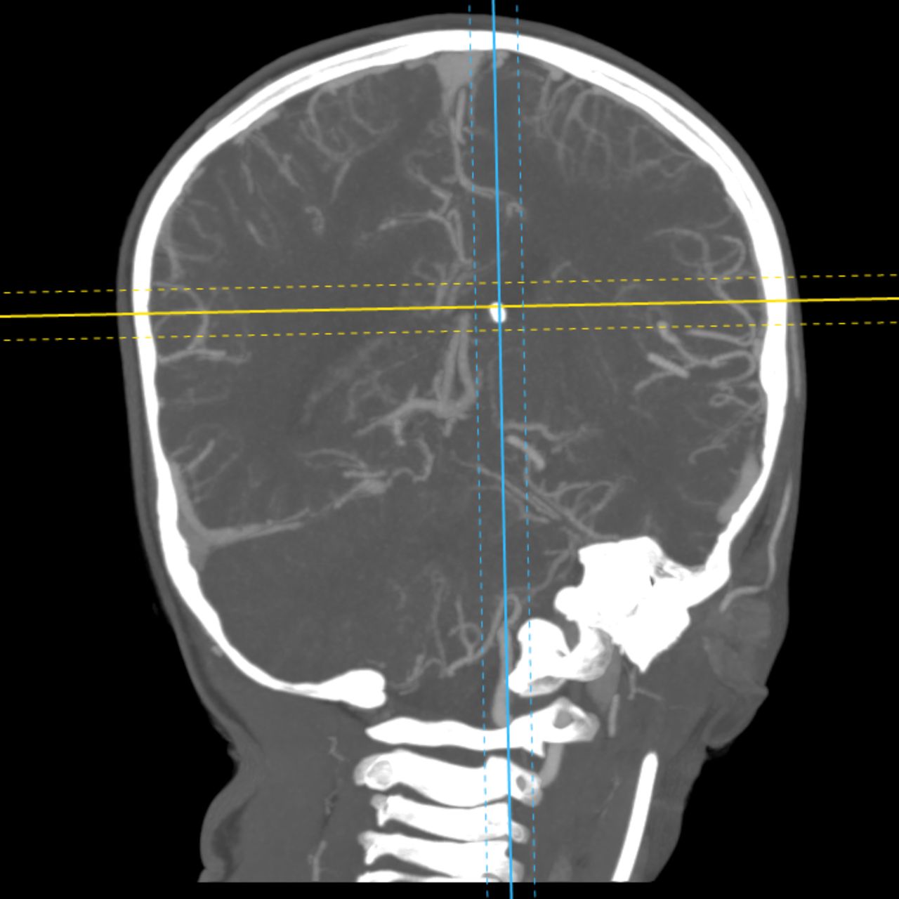 David Tafur Muñoz-1983