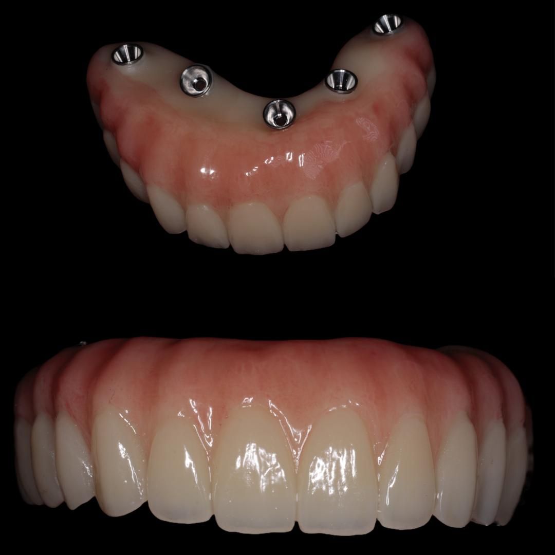 Alejandro Palacio Holguín-0