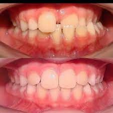 Vasti Mendes Antunes-5