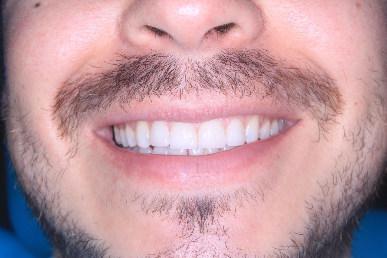 Francisco Bahamonde-11