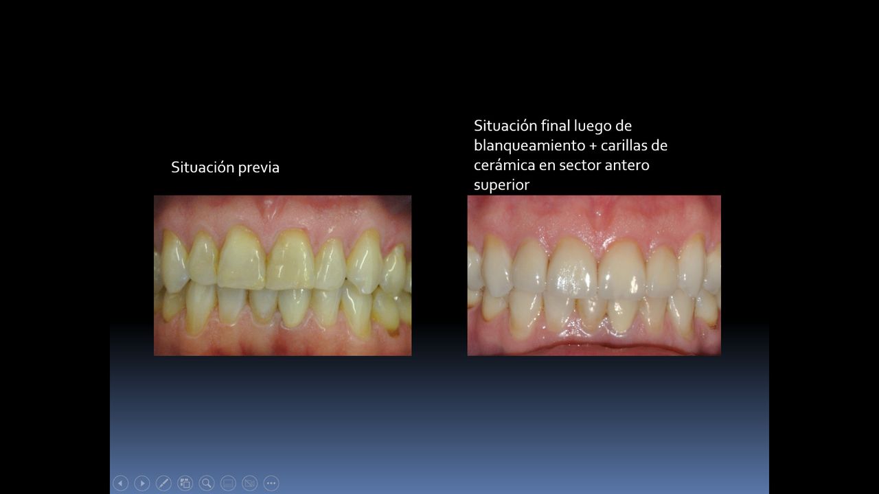 Sebastián Vicente-4