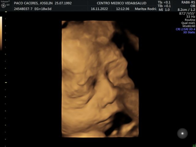 Maritza Rodriguez Balanta-14