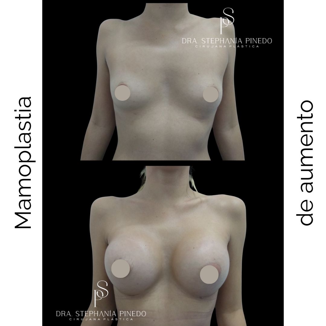 Stephanía Pinedo García-16