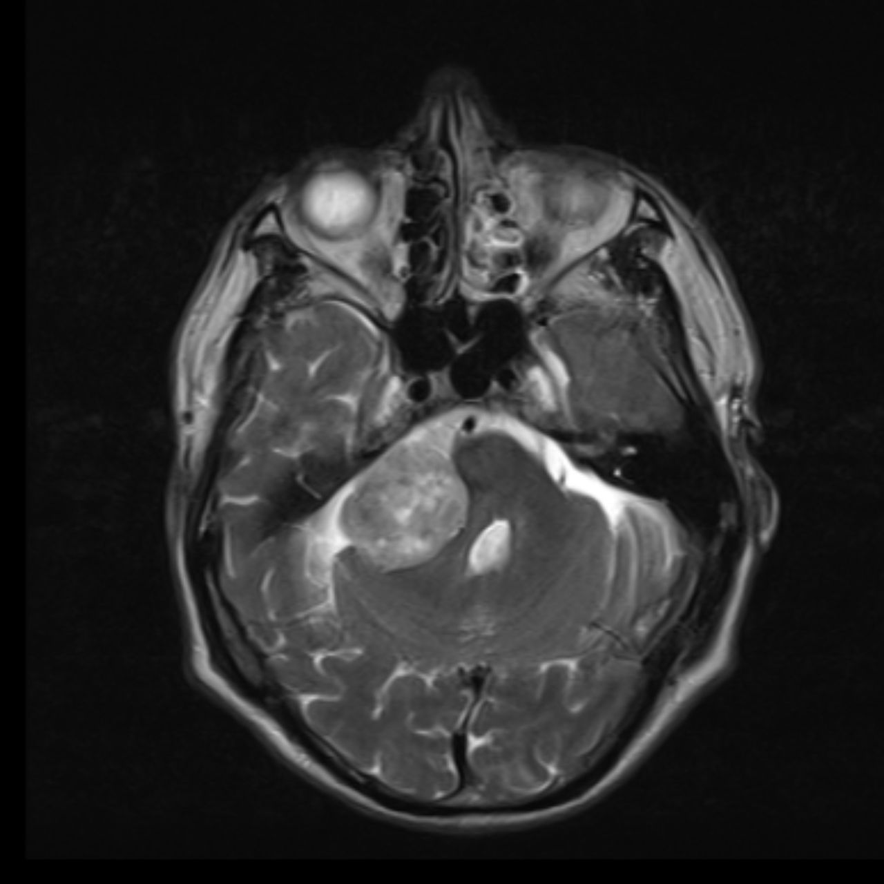 David Tafur Muñoz-1849