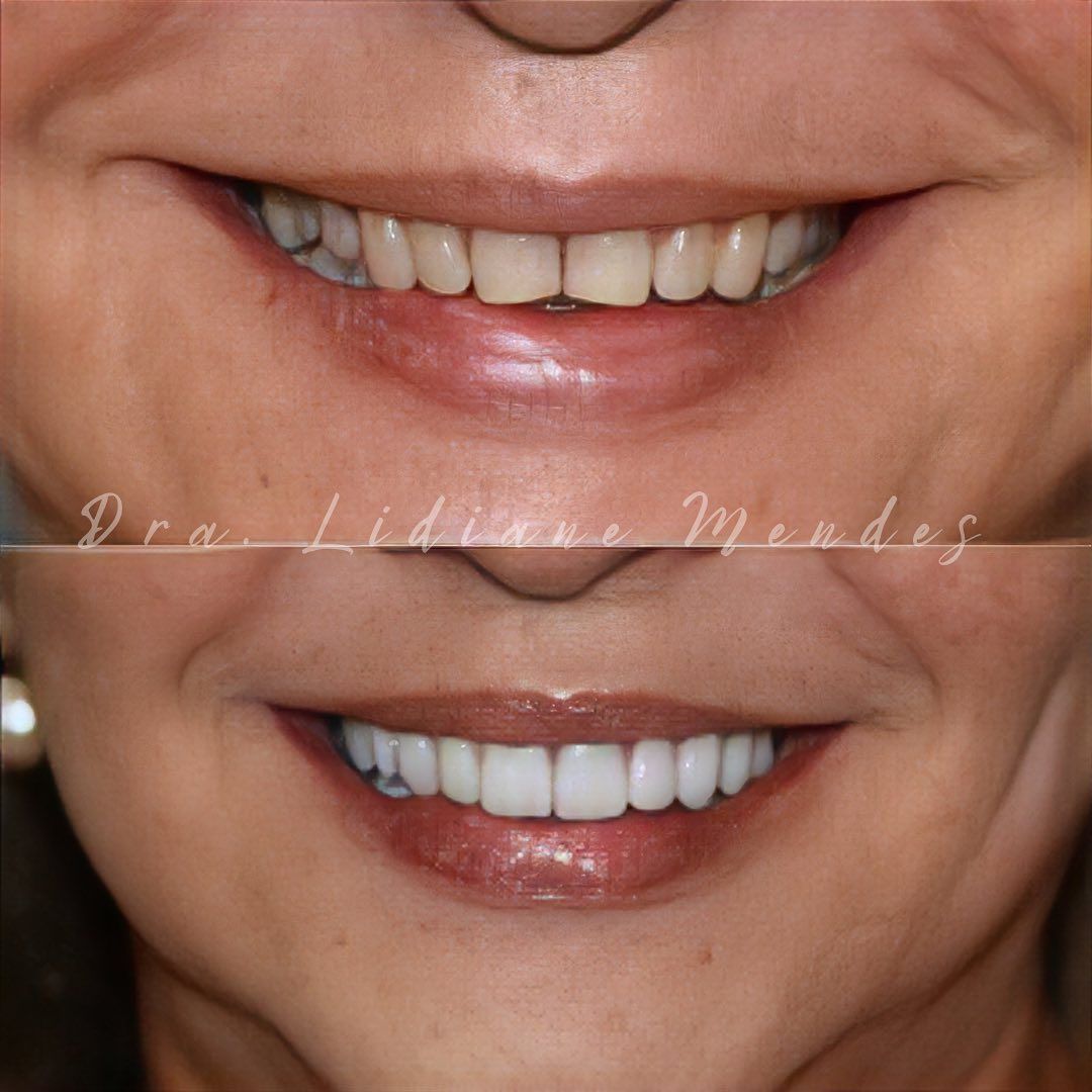 Lidiane Morais Mendes-29