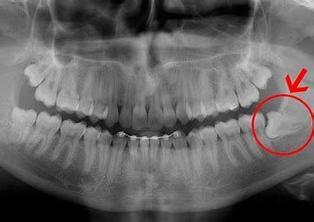  Evandro  Carneiro Martins Neto-1
