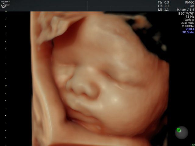 Raul Javier Banderas Pumarino-28