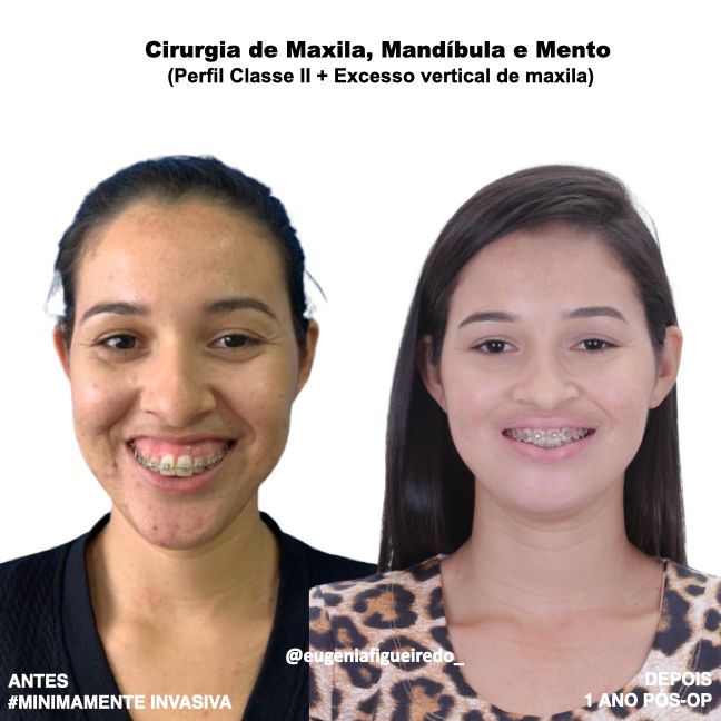 Eugênia Figueiredo-35