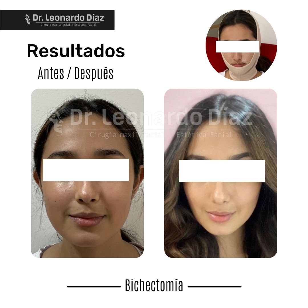 Leonardo Diaz Martínez-7