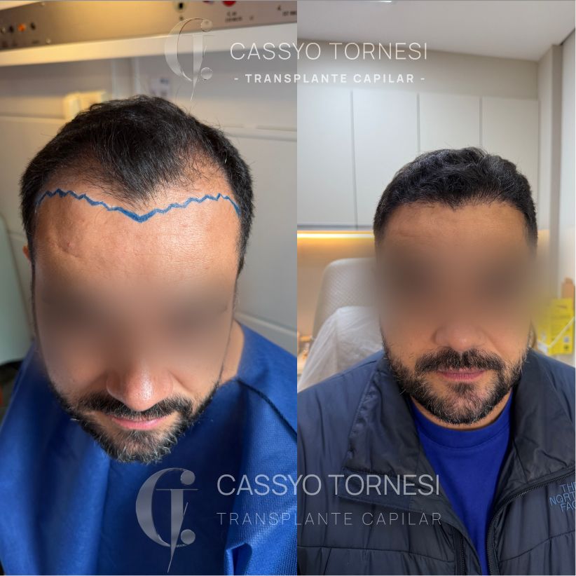 Cassyo Tornesi-20