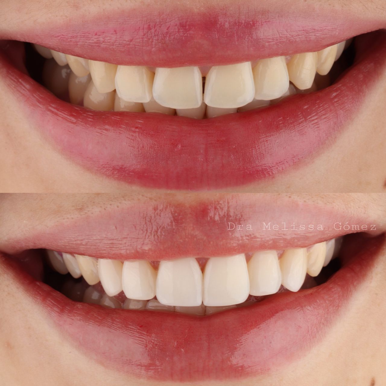 Melissa Gómez Arango-17