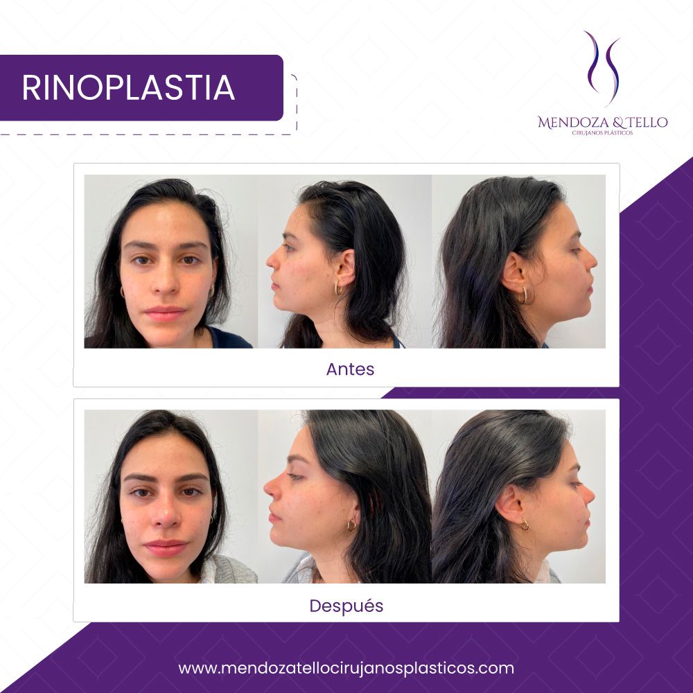 Alexander Mendoza-32