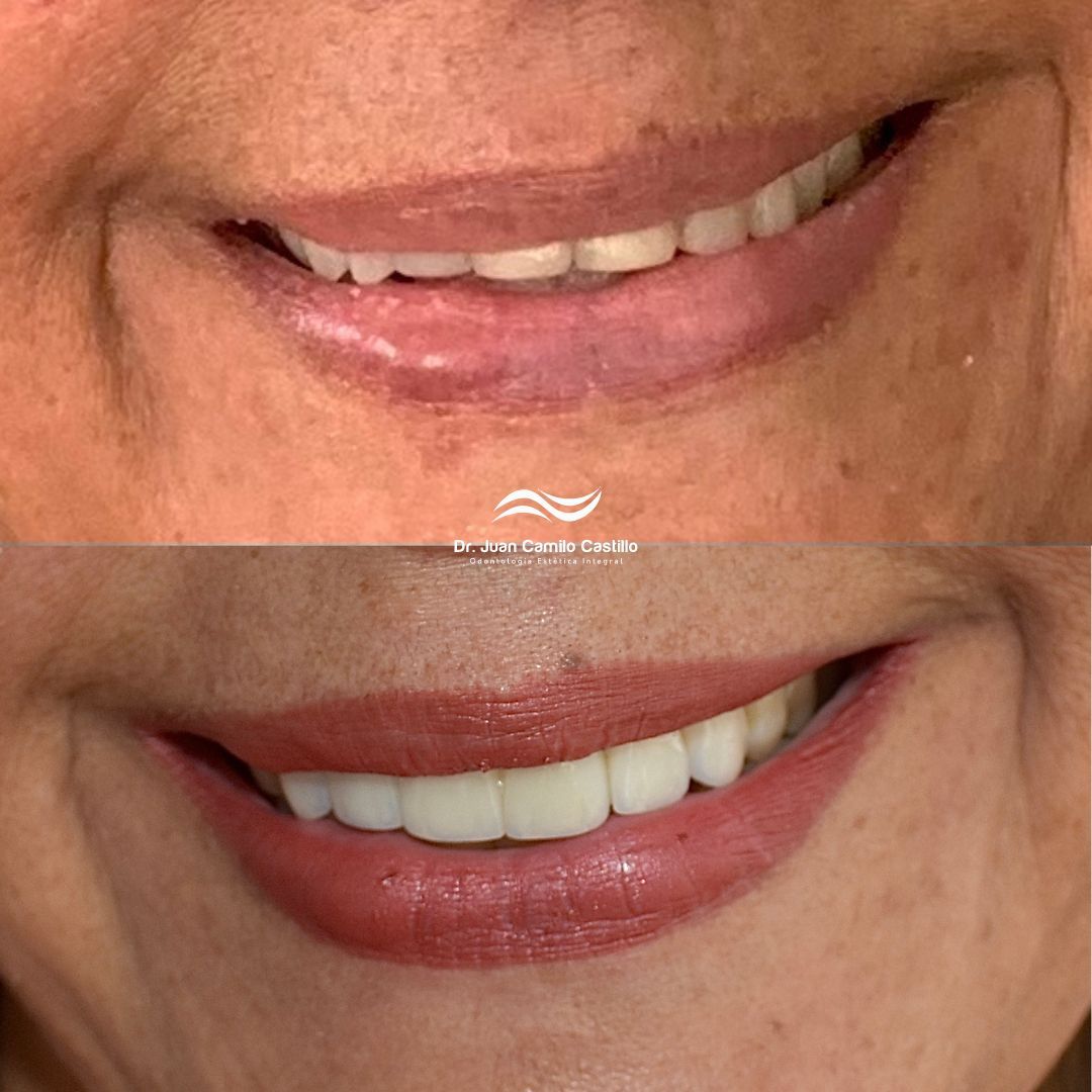 Juan Camilo Castillo-12