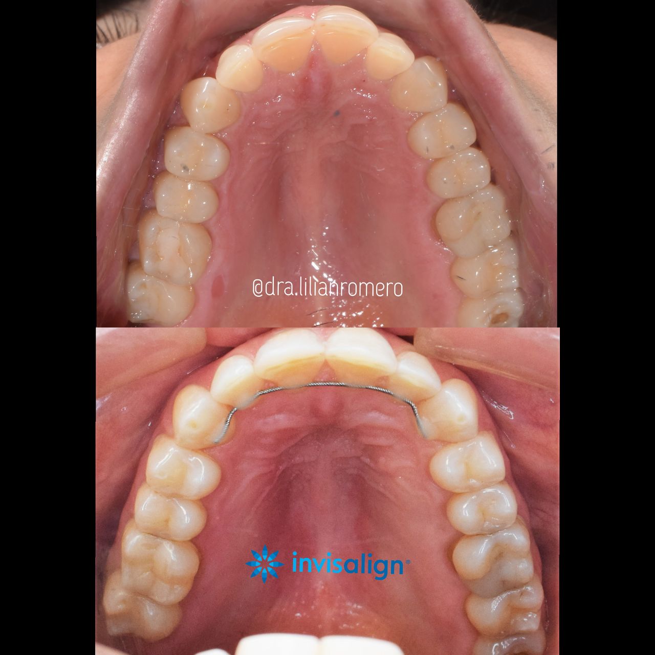 Lilian Catalina Romero Diaz-9