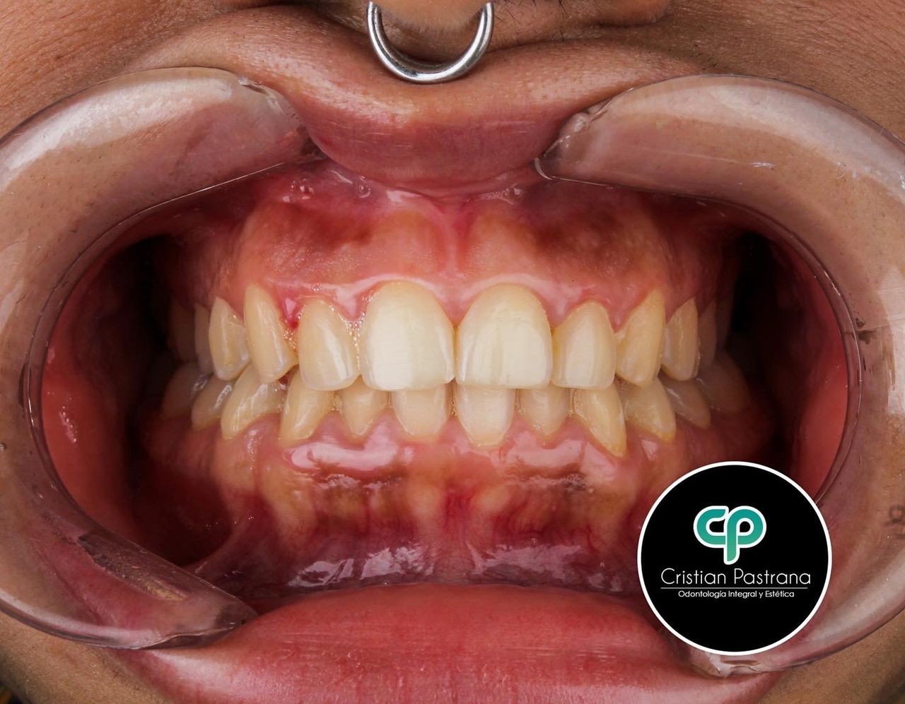 Cristian Pastrana Corrales-5