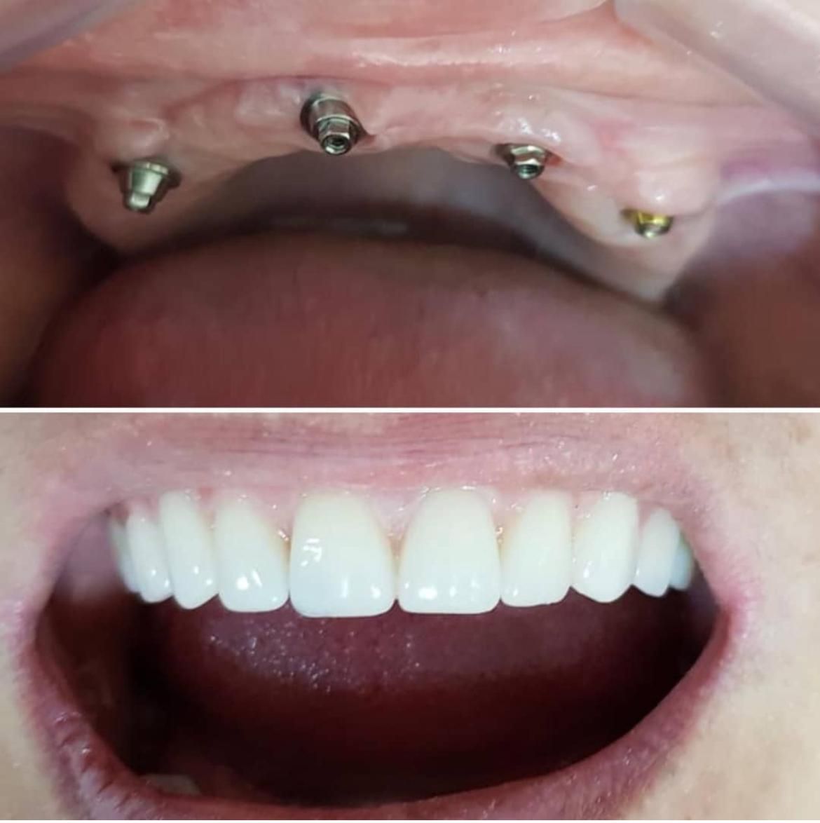 Almirando Eugenio De Lima Junior-0