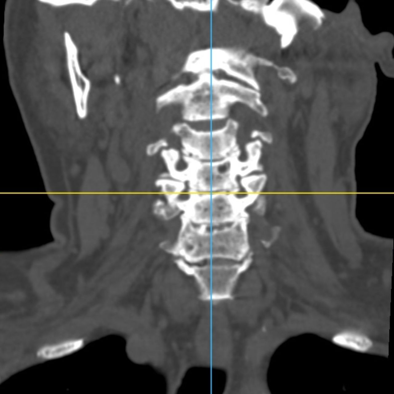 David Tafur Muñoz-1761