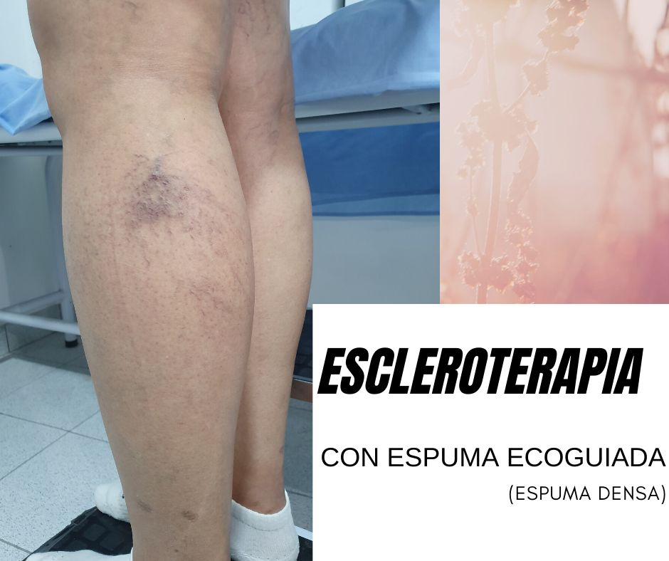 Cindy Vásquez Marzano-13