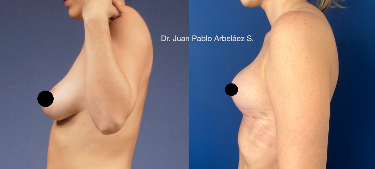 Juan Pablo Arbeláez Sierra-7