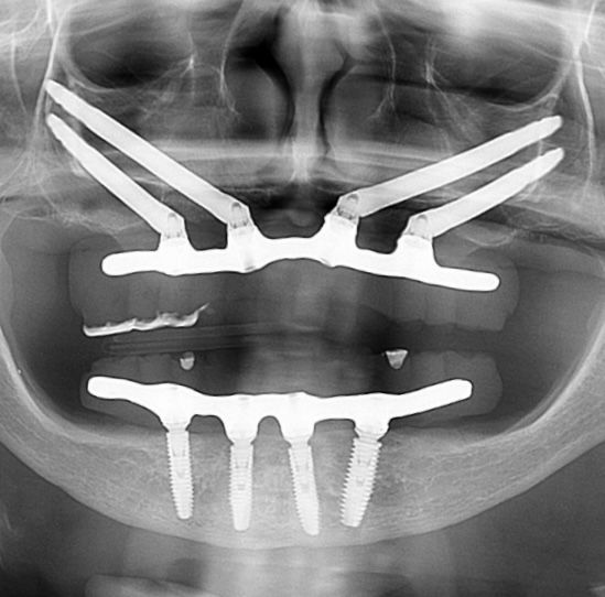 Caroline Benedeti-41