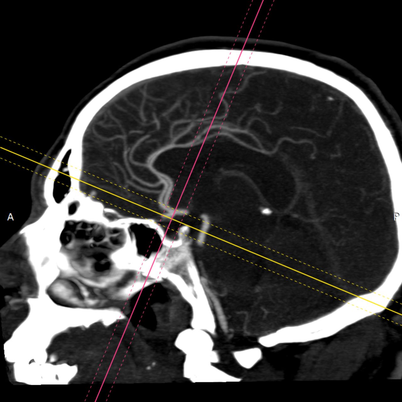 David Tafur Muñoz-1511