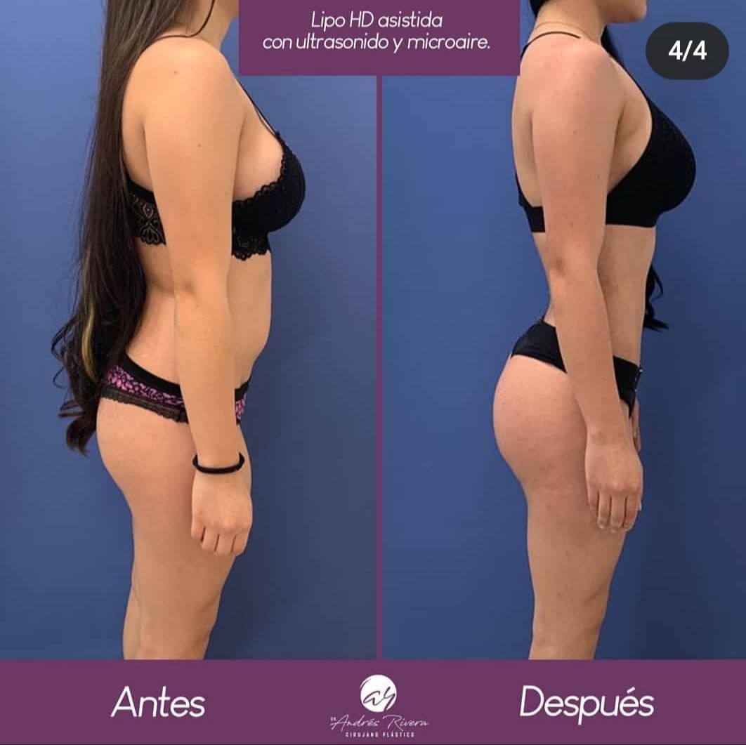 Andrés Rivera López-28