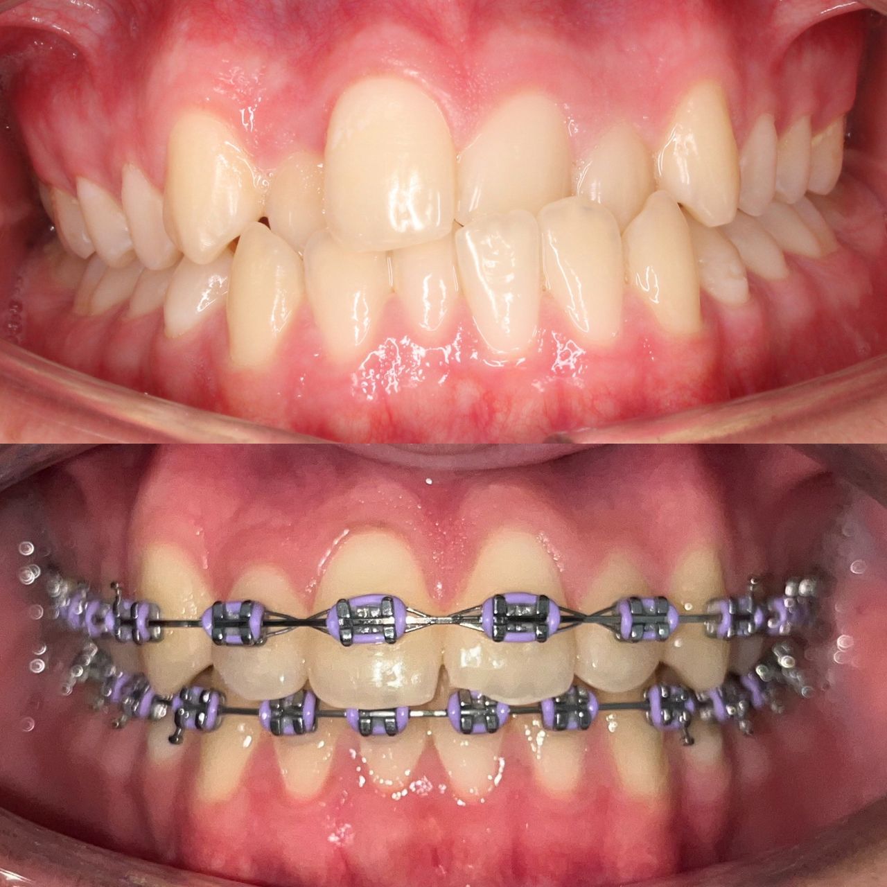 Carlos Manterola Marchant-4