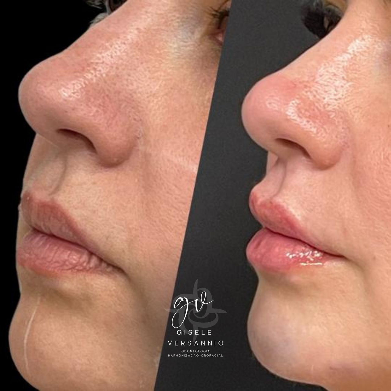 Gisele De Carvalho Versannio-33