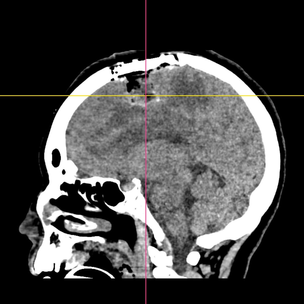 David Tafur Muñoz-1955