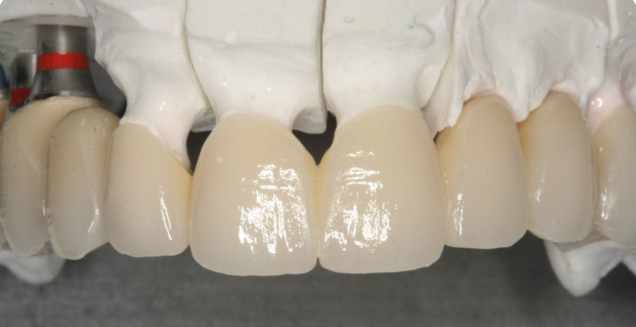 Juan Carlos Gac Pasten-7