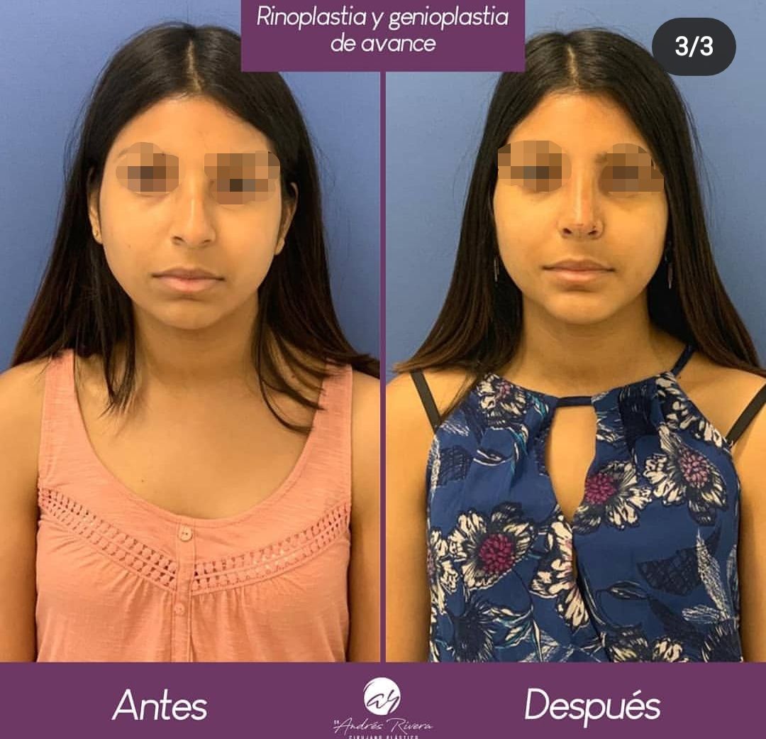 Andrés Rivera López-41