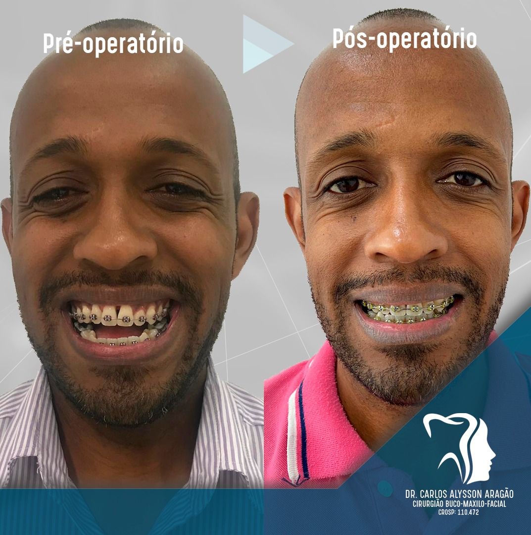 Carlos Alysson Aragão-27