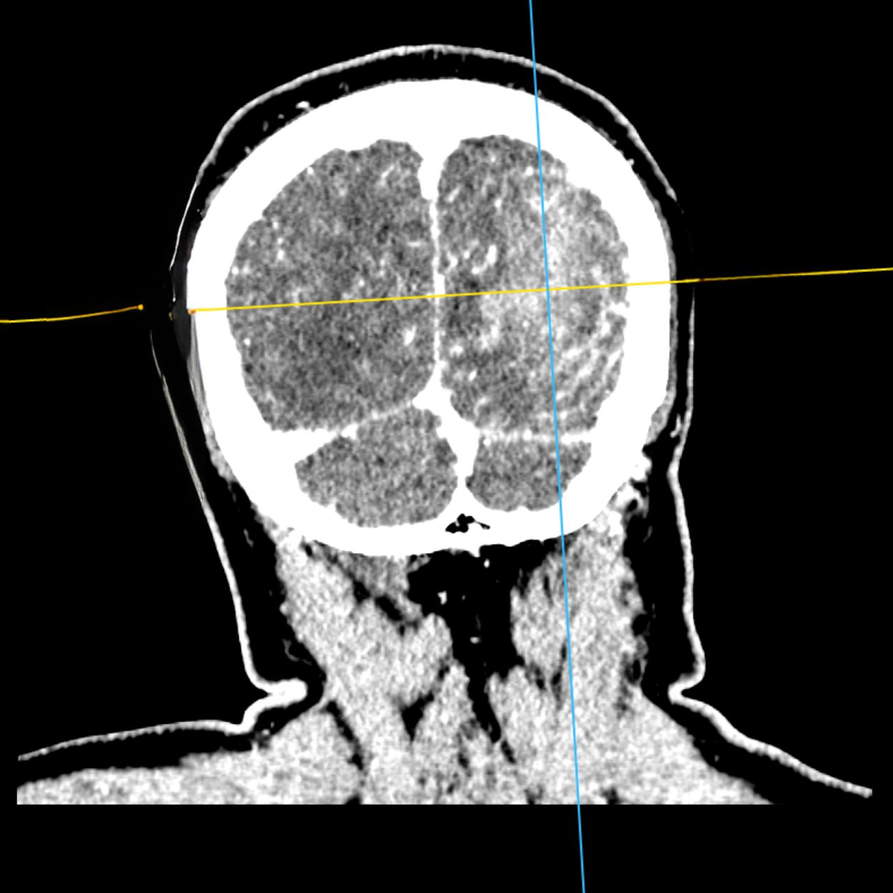 David Tafur Muñoz-1784