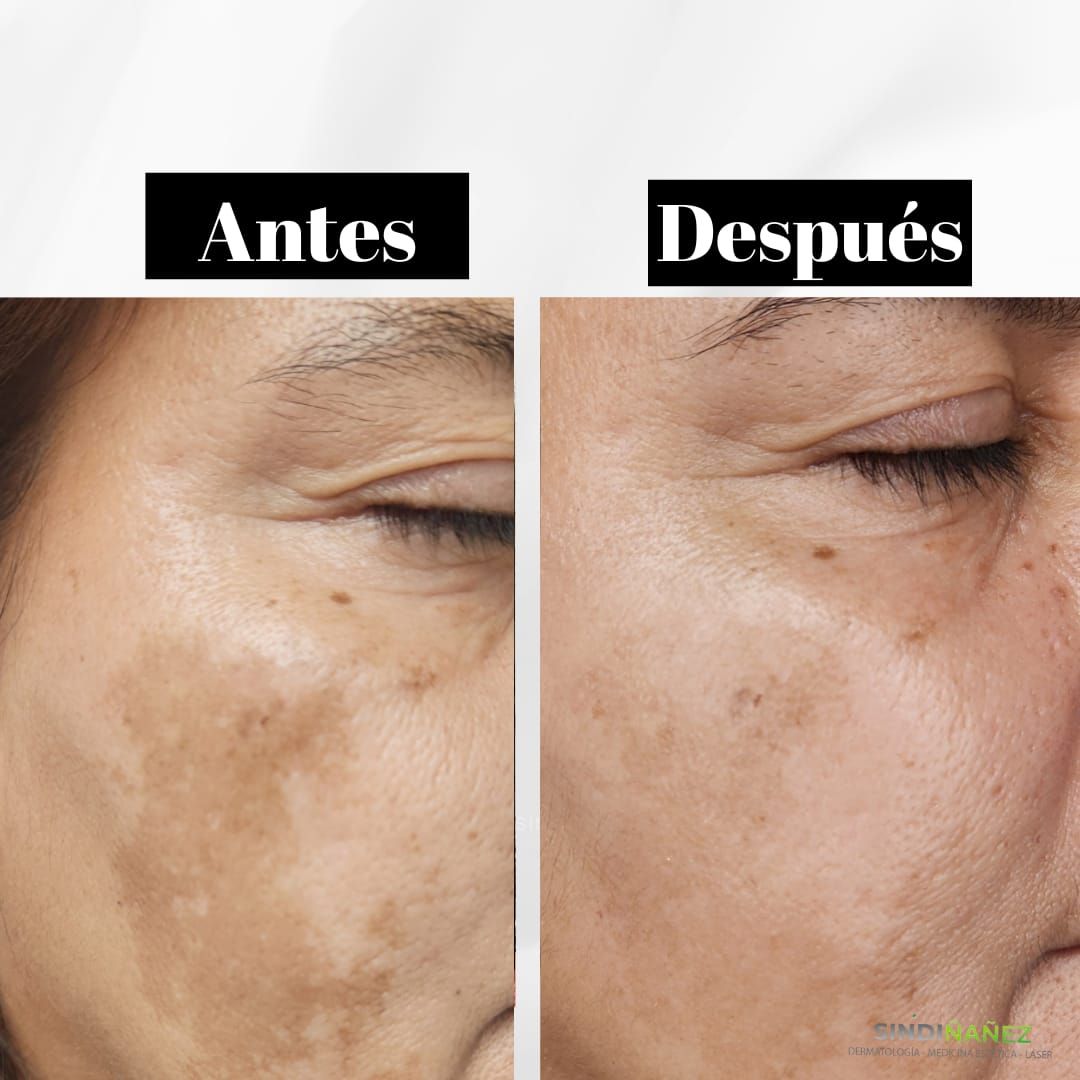 Sindi Lorena Ñañez Aguirre-5