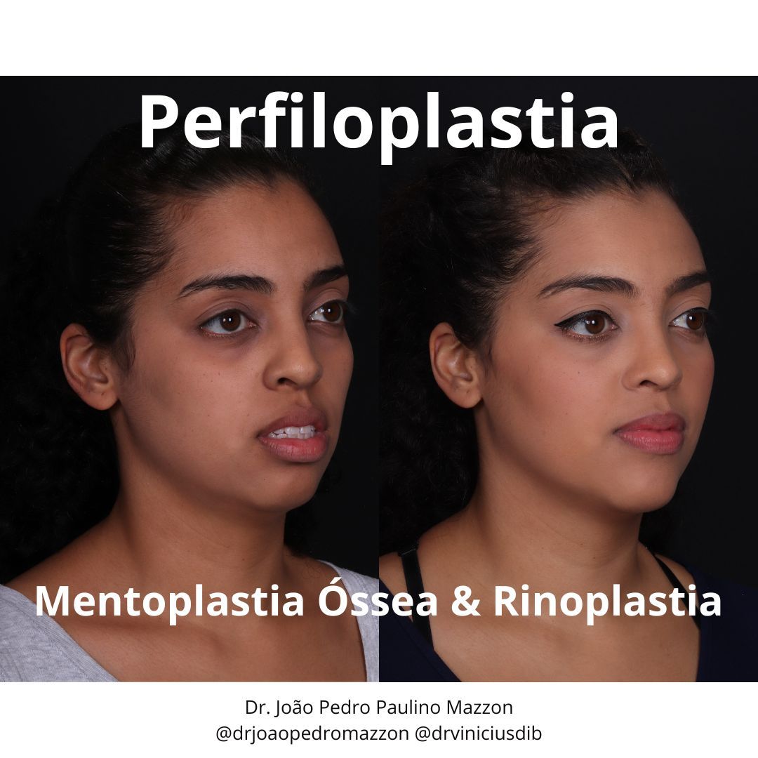 João Pedro Paulino Mazzon-17