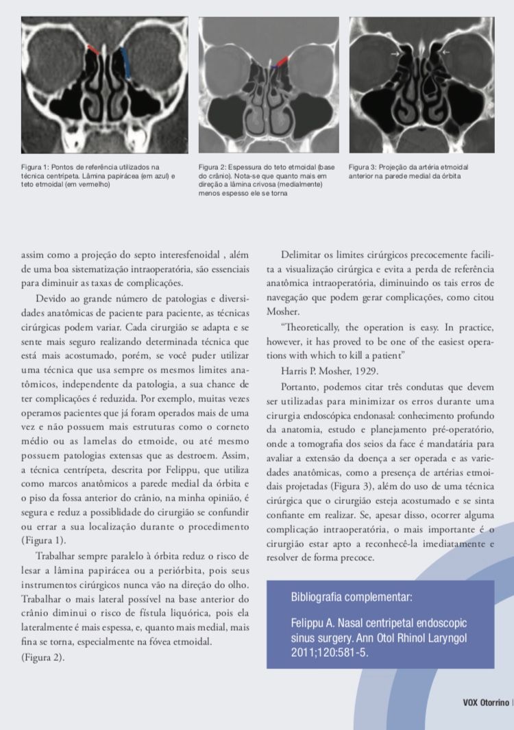 Bernard Beraldin-3