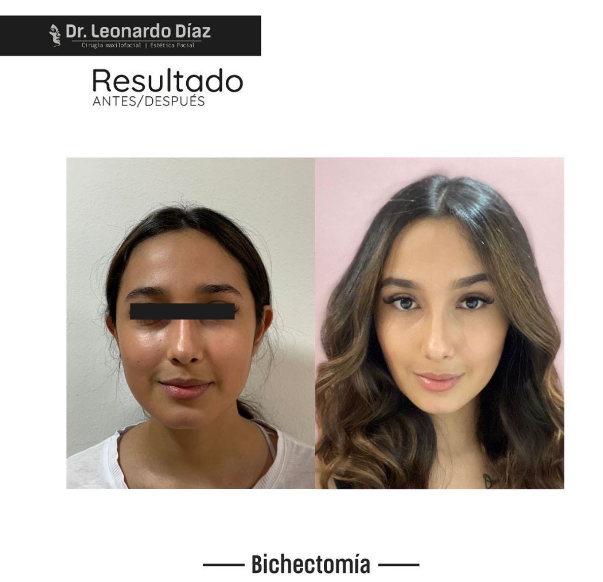 Leonardo Diaz Martínez-17