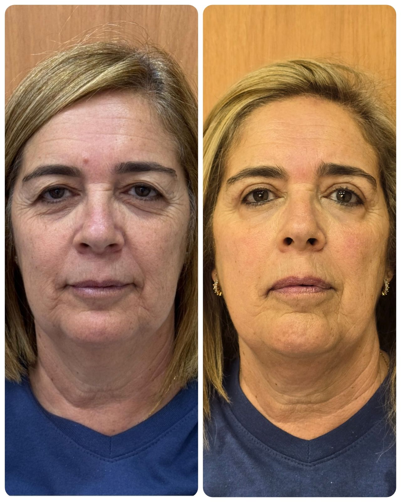 Pedro Henrique Faria Denofrio-15