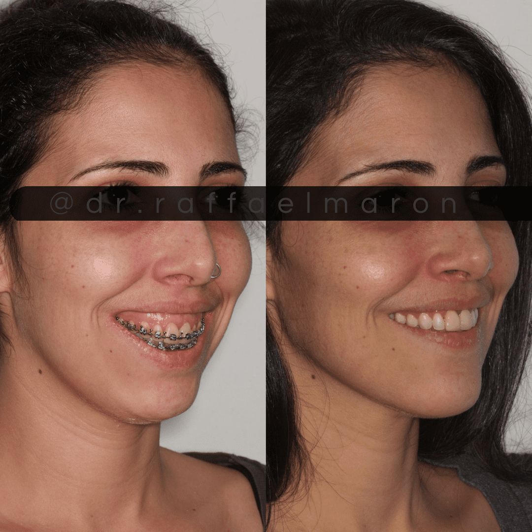 Raffael Maron Vieira De Noronha-15