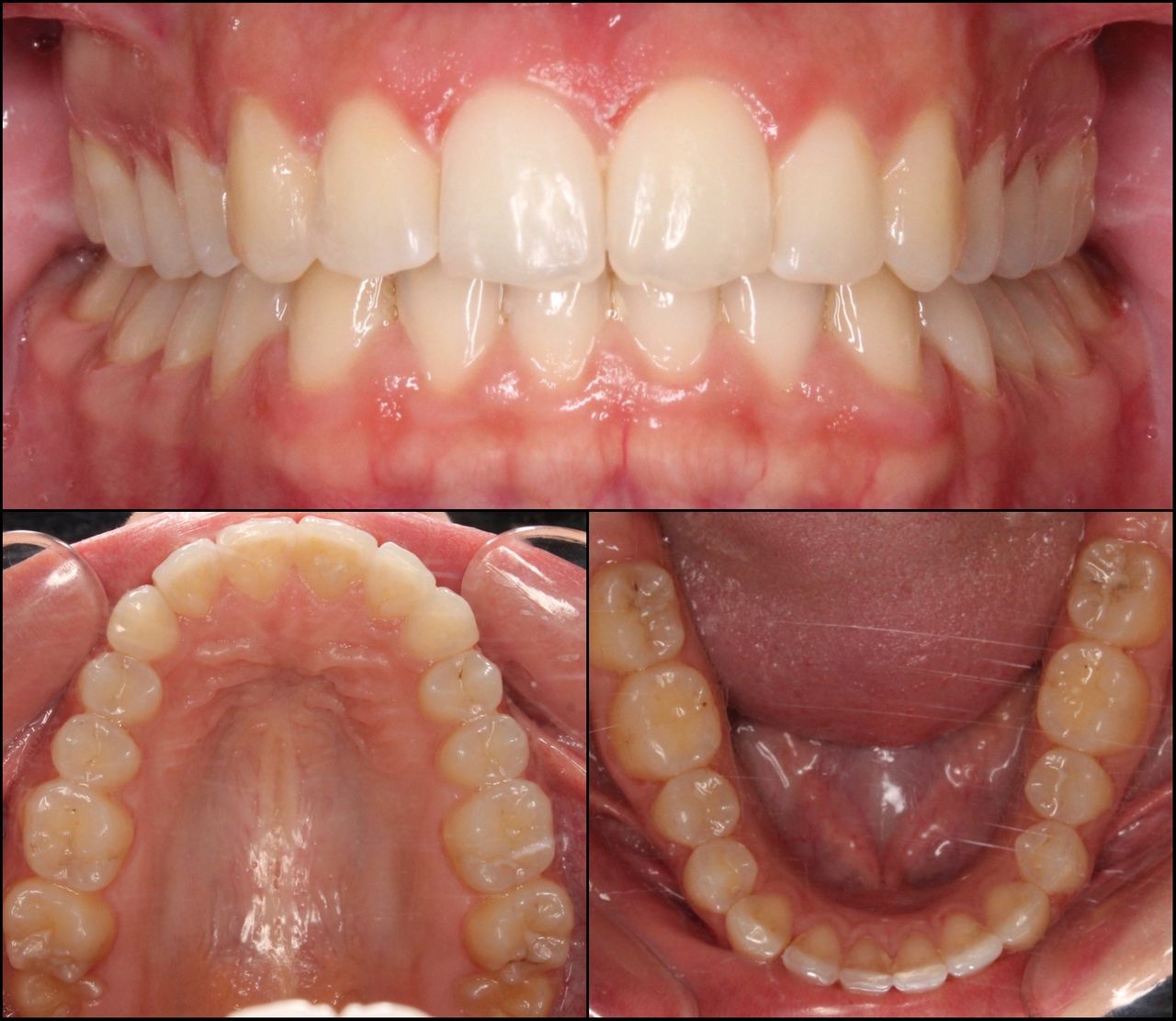Carlos Manterola Marchant-3