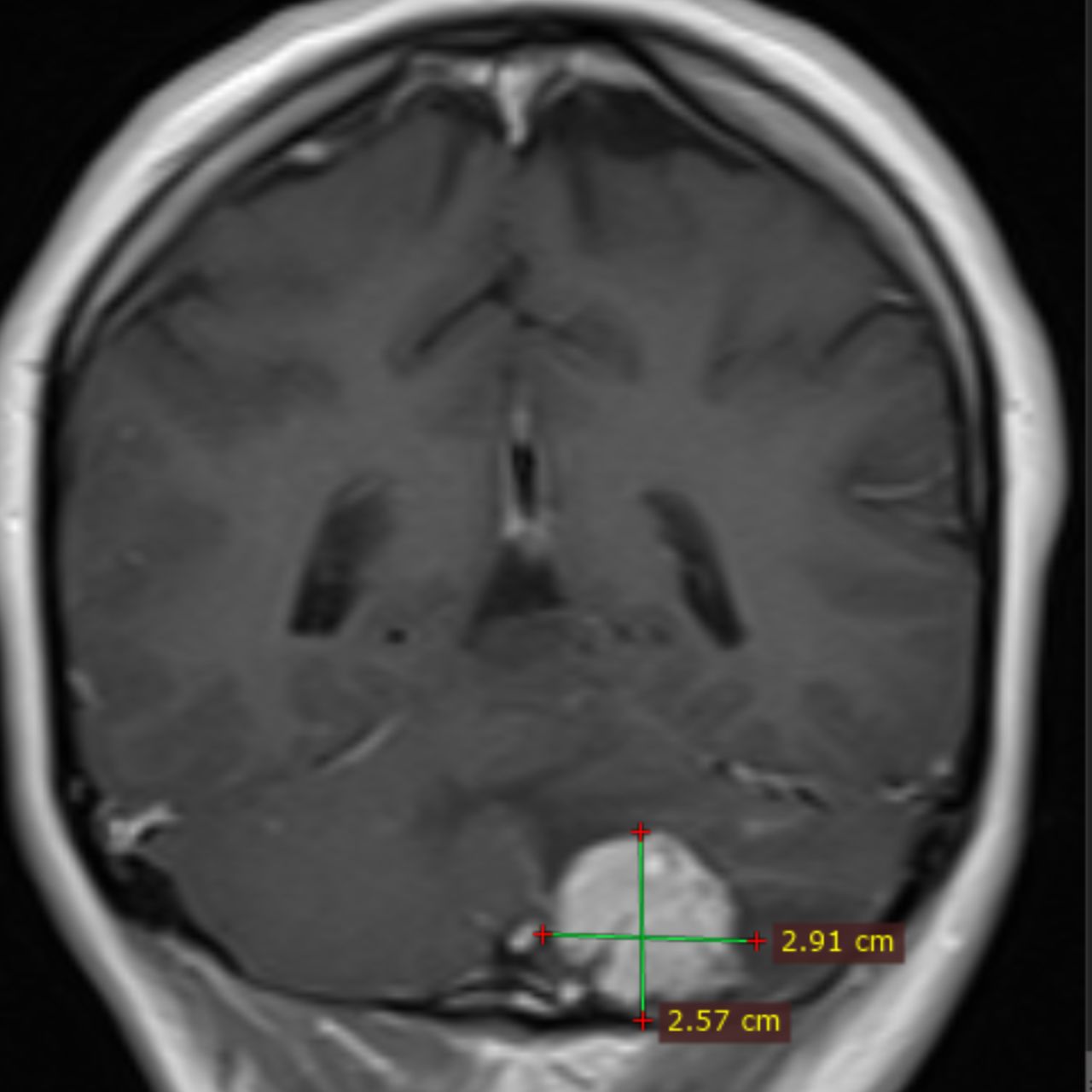 David Tafur Muñoz-2051