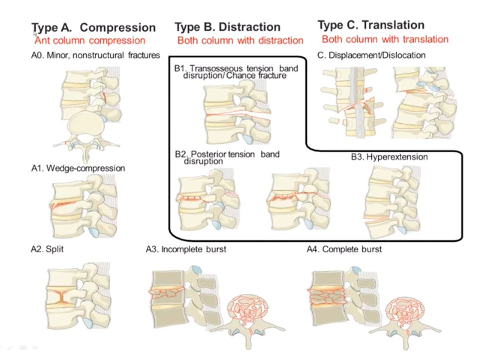 José Lopes Sousa Filho-81